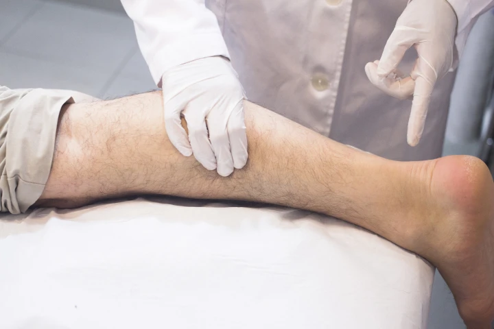 A Simple Understanding of Varicose Veins