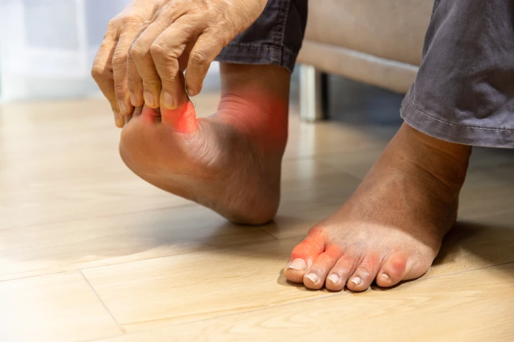 Loss of Sensation and Its Impact on Walking